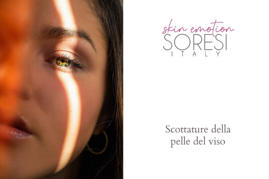 Scottature della pelle del viso, come rimediare?